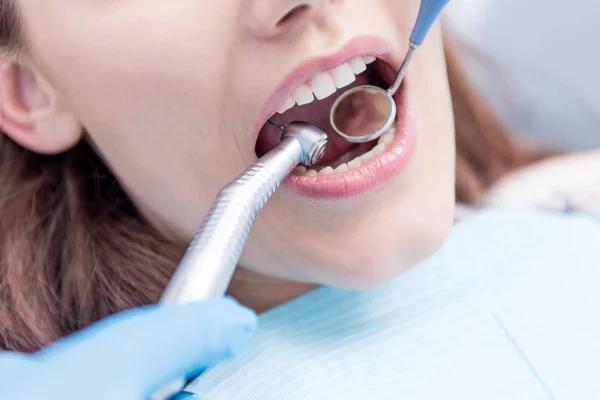 Fast Help When You Need an Emergency Dentist Dallas